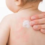 Mustela Stelatopia Range