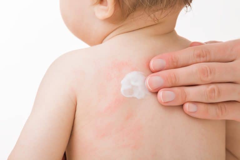 Mustela Stelatopia Range